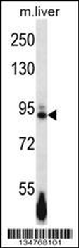 Mouse Ephb4 Antibody (Center)