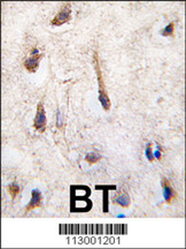 ERAS Antibody (N-term) (F66)