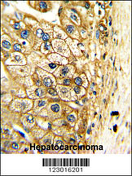 ALDH3A2 Antibody