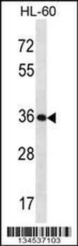 KLK9 Antibody (Center)