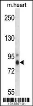 Mouse Prkch Antibody (Center)