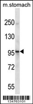 Mouse Epha1 Antibody (Center)