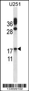 CGB/hCG-Beta Antibody (Center)