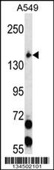EIF2AK3 Antibody (N-term)