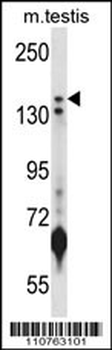 JARID1B Antibody (N-term)