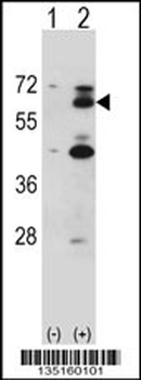 Mouse Yes1 Antibody (N-term)