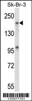 Mouse Map4k4 Antibody (Center)