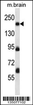 Mouse Map4k4 Antibody (Center)