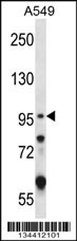 GRIK2 Antibody (C-term)