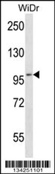 EIF4ENIF1 Antibody (N-term)