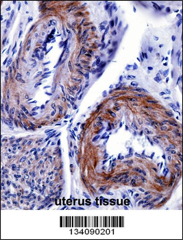TRIP6 Antibody (N-term)