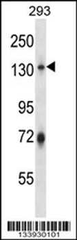 RNF20 Antibody (N-term)
