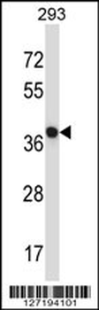 NECAB1 Antibody (Center)