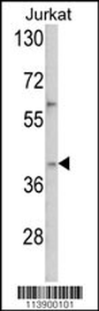 YBX2 Antibody (C-term)