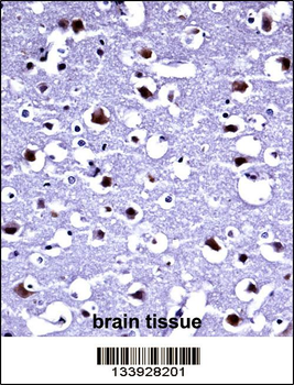 TARBP2 Antibody (N-term)