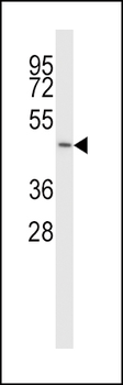 SLC38A5 Antibody (N-term)