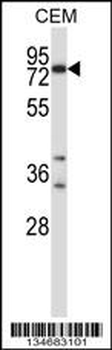 Mouse Plk2 Antibody (Center)