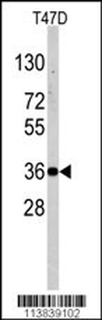 Nanos Homologue 1 (NANOS1) Antibody (C-term)