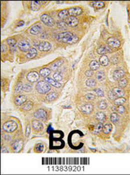 Nanos Homologue 1 (NANOS1) Antibody (C-term)