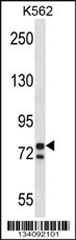 PCSK7 Antibody (C-term)
