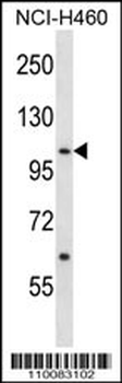 ACK1 Antibody (Center Y284)