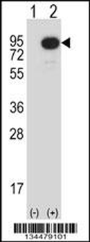 Mouse Map3k2 Antibody (N-term)