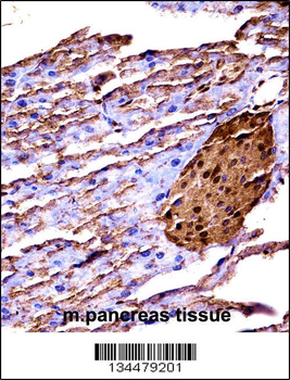 Mouse Map3k2 Antibody (N-term)