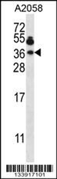VAMP7 Antibody (Center)