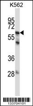 MMP11 Antibody (C-term)