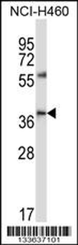 CD33 Antibody (Center)
