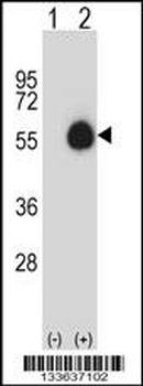 CD33 Antibody (Center)