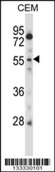 CSRNP2 Antibody (C-term)