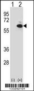 GOPC Antibody (C-term)
