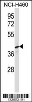 PELI3 Antibody (N-term)