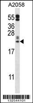PRX2LA Antibody (C-term)
