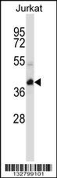 KCTD10 Antibody (C-term)