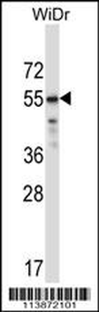 TFCP2L1 Antibody (Center)