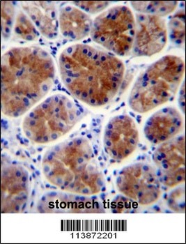 TFCP2L1 Antibody (Center)