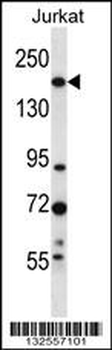 UGCGL1 Antibody (C-term)