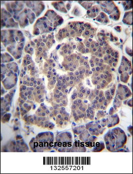 UGCGL1 Antibody (C-term)