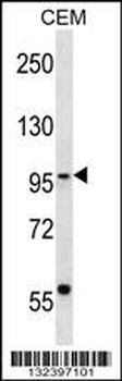 SEC63 Antibody (N-term)