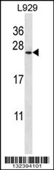 COPZ1 Antibody (N-term)