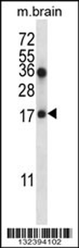 COPZ1 Antibody (N-term)