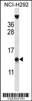 PYDC1 Antibody (Center)