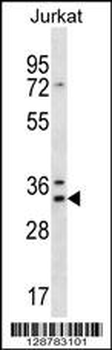 DNAJC9 Antibody (N-term)