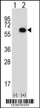GK Antibody (N-term)