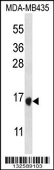 TAC4 Antibody (C-term)