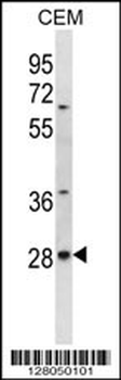 ALKBH4 Antibody (Center)