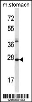 ALKBH4 Antibody (Center)
