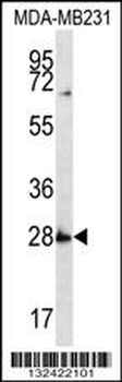 SYPL1 Antibody (N-term)